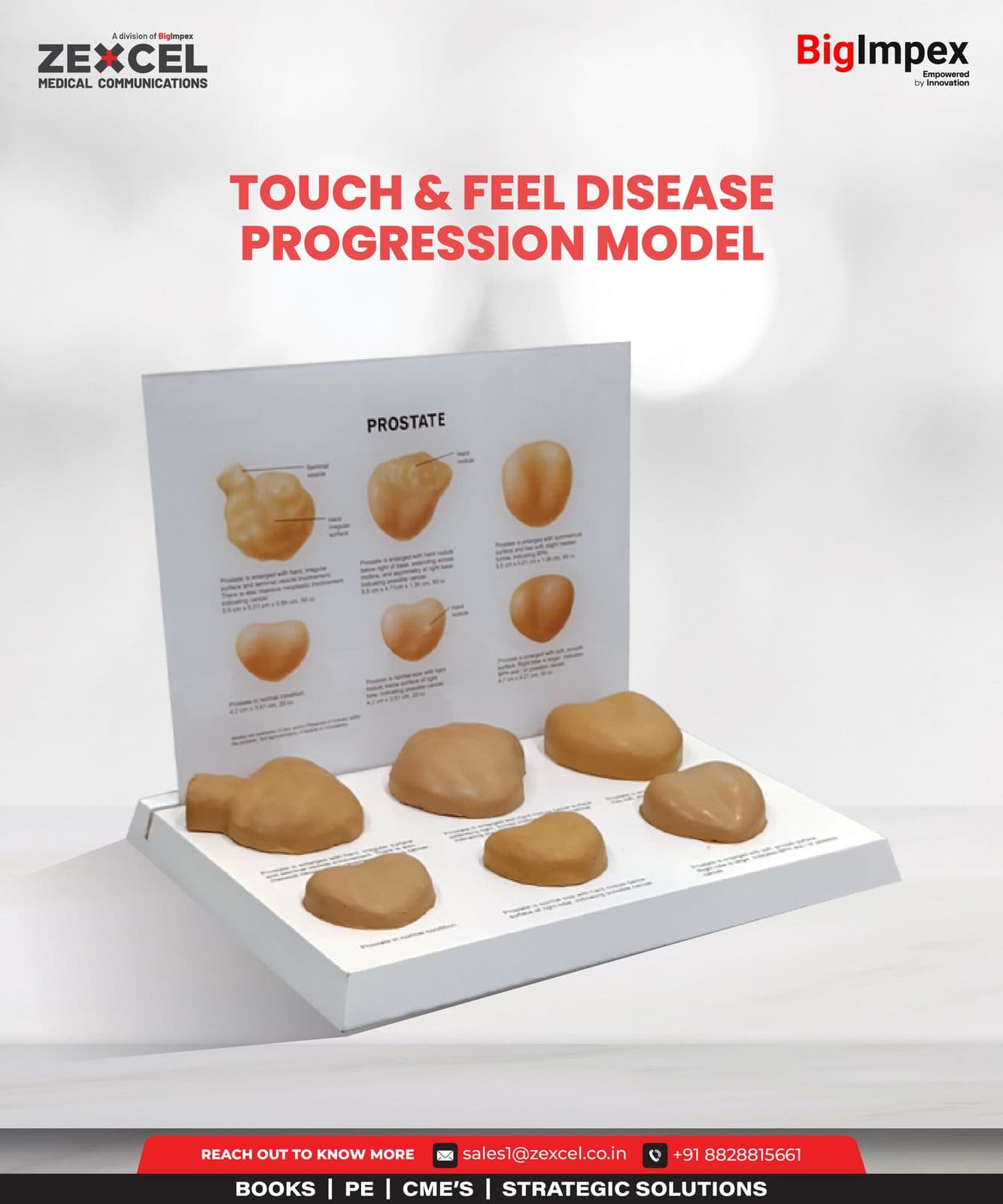 Touch & Feel disease Progression model for zexcel